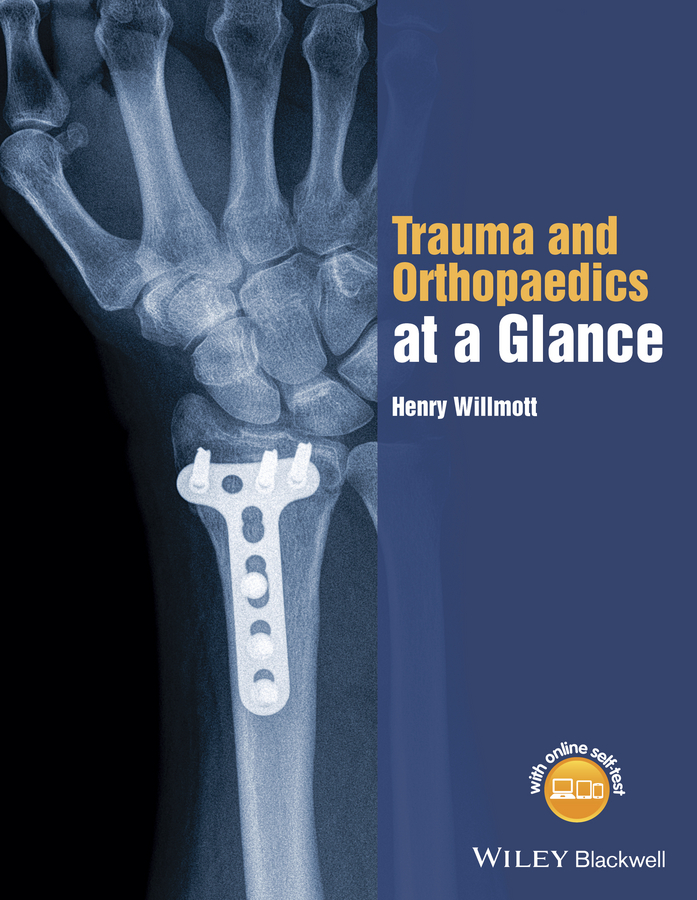Willmott: Trauma and Orthopaedics at a Glance