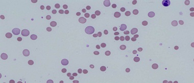 haematology at a glance pdf