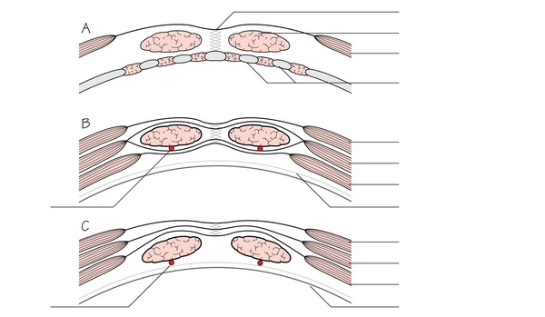 Figure 15.3