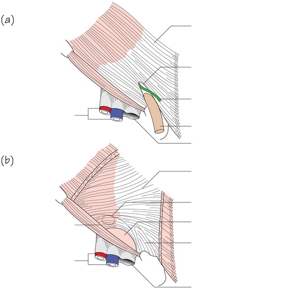 Figure 15.4