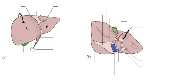 Figure 18.3