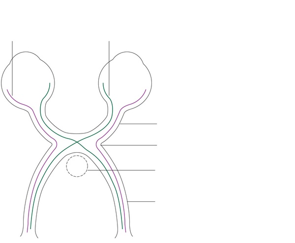 Figure 61.1